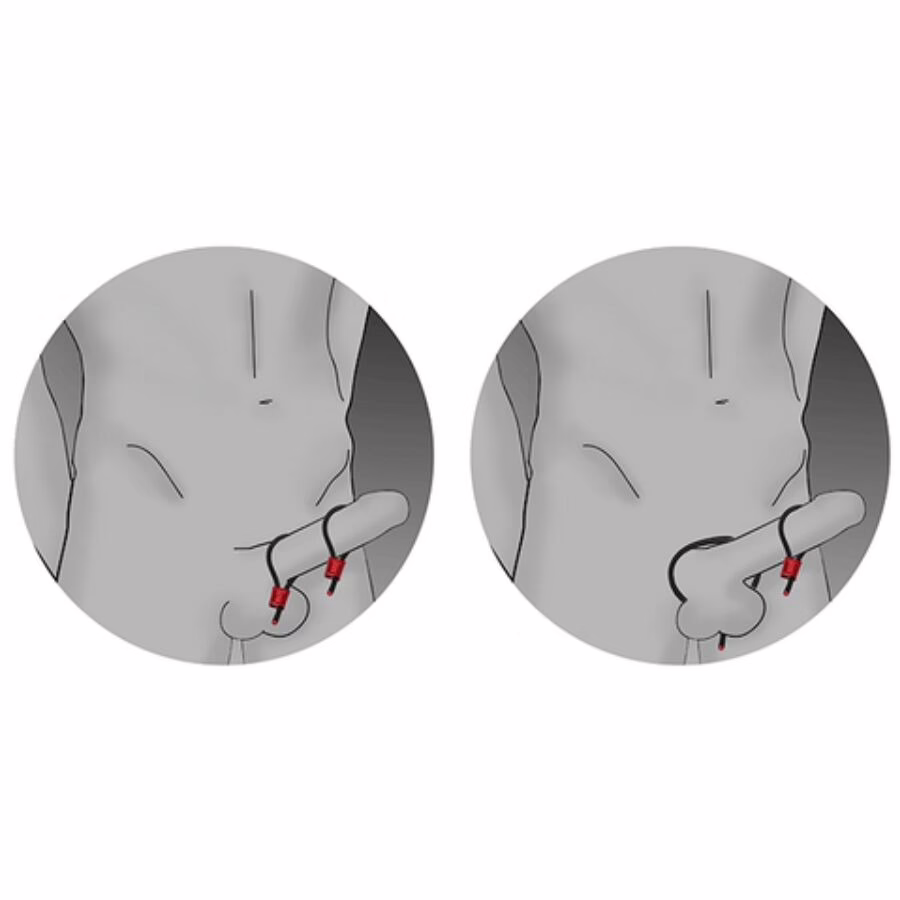 ELECTRASTIM - PRESTIGE ELECTRA LOOPS ANILLOS DE PENE AJUSTABLES ROJO - Imagen 3